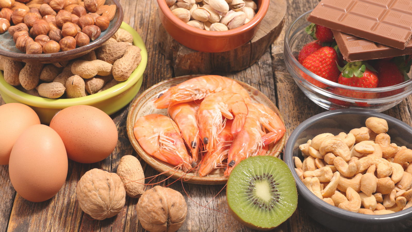 5 Facts About Food Allergies 2
